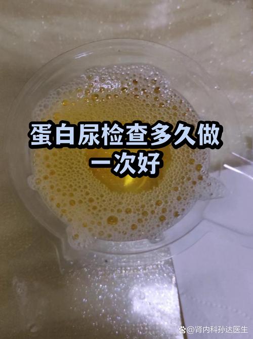 澳洲 体检 尿检 补